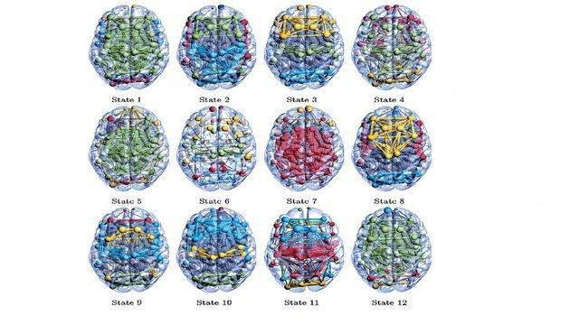 کشف 12 حالت مخفی در مغز